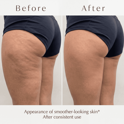 Mabélle Cellulite Oil