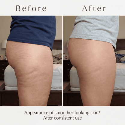 Mabélle Cellulite Oil